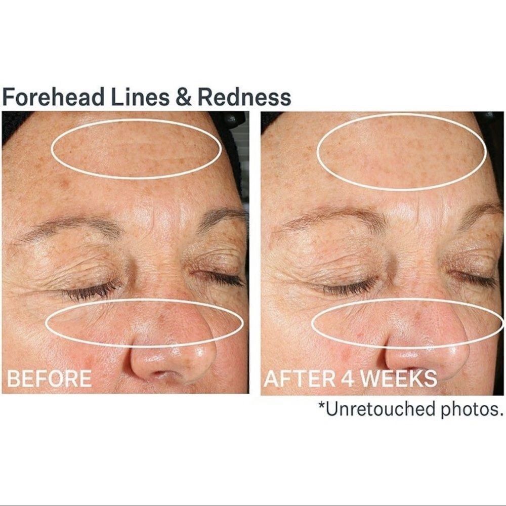 $15🌟 StriVectin Anti-Wrinkle SD Advanced Plus Intensive Moisturizing Cream - Picture 3 of 12